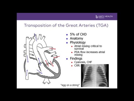 Introduction to Pediatric Echocardiograms and Common Critical Congenital Heart Defects