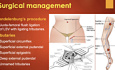 Varicose Veins