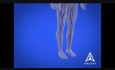 Diabetes Education - 3D Medical Animation