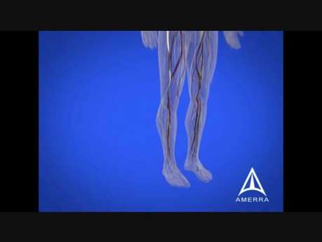 Diabetes Education - 3D Medical Animation