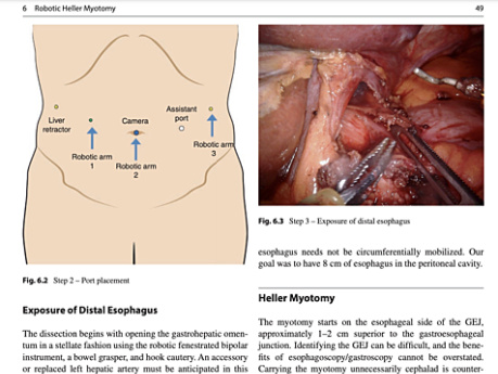 Robotic-Assisted Minimally Invasive Surgery