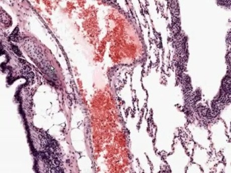 Lung - Histology