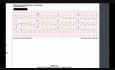 ECG Case 2