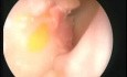 SIMONT ear, nose, throat and skull base simulator