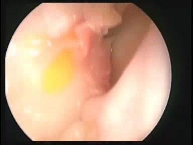 SIMONT ear, nose, throat and skull base simulator
