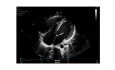 Interesting Cases in the﻿ St. Michael's Hospital Echo Lab