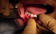 Part 4/8: Root Coverage Surgery - Mandibular Premolar - Placement Into Recipient Site