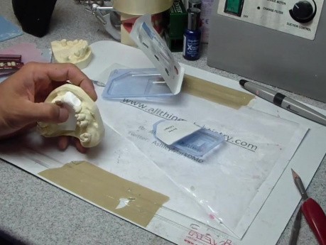 Dental Membranes - Template It And Make Your Life Easier.A Little.