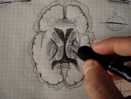 Internal capsule and nuclei - Neuroanatomy Lectures - 31