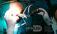 Trans Anal Endoscopic Operation for A Large Villous Adenoma