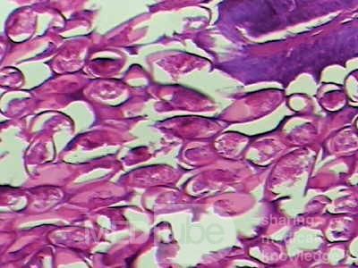 Trichuris Trichuris (whipworm) (7 of 10)