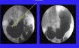 The Oesophageogastrointestinal Sphincters