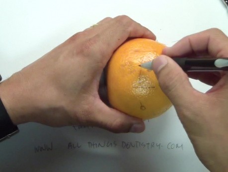 Practice Harvesting Connective Tissue From The Palate