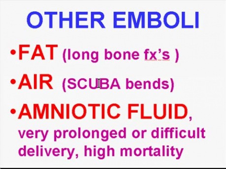 Hemodynamic Disorders, Thromboembolic Disease and Shock - MSP - 4i