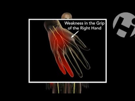 Injuries
