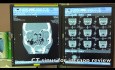FESS Intro for Surgeons