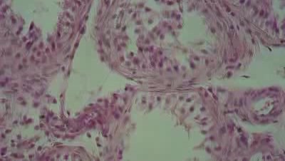 Transverse section of a seminiferous tubule