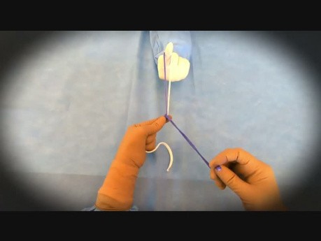 Laparoscopic Roeder's Knot