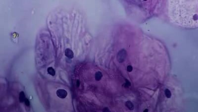 Endometrium