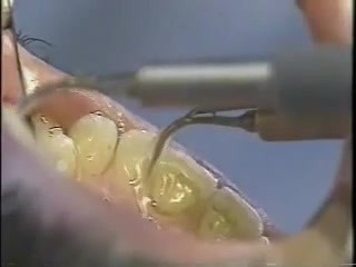 best way to have your teeth cleaned
