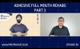 Adhesive Full Mouth Rehabs Part 3 - PDP110