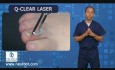 New Laser Treatment for Toenail Fungus