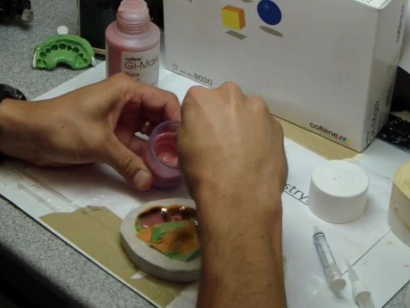 Moulaging An Implant Supported Denture Impression - Old School With Gi-Mask