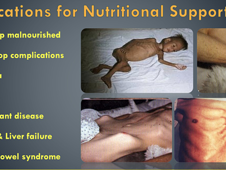 Nutrition & Haemostasis