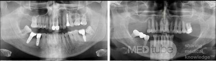 Assesment of Lesion