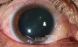 Ocular Trauma (before)