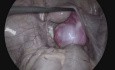 Basic Laparoscopic Anatony
