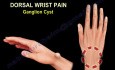 Causes and Treatment of the Wrist Pain - Part 2
