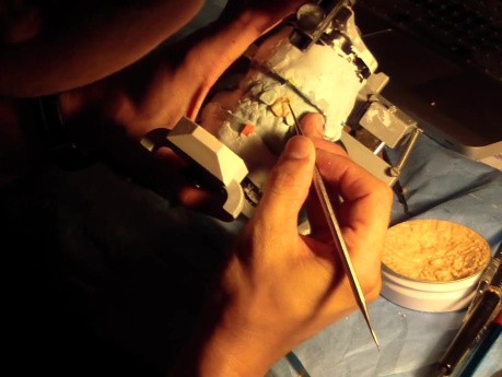 Diagnostic Waxup Part 5