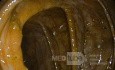 Endoscopic appearance of the Pseudomembranous colitis