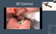 VF Master Class Rectal Cancer Management