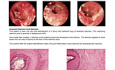 Diseases of the Ear Volume 2 The External Ear Canal
