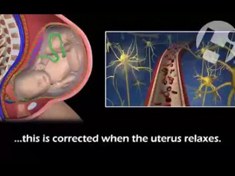 Contraction Effects