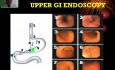 Upper GI Endoscopy - a Pictorial Overview