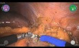 Robotic Left Partial Nephrectomy with Versius - Maurizio De Maria