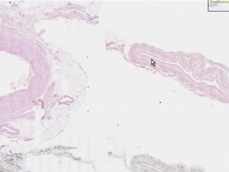 Medium Artery and Vein - Histology