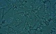 Urina - Salt crystals
