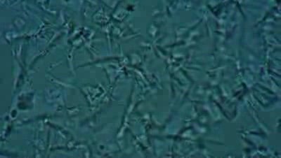 Urina - Salt crystals