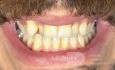 Orthodontic Case, What Treatment Plan?