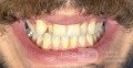 Orthodontic Case, What Treatment Plan?