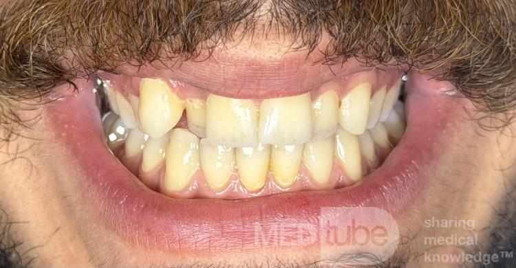 Orthodontic Case, What Treatment Plan?