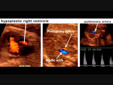 Standard Views in Fetal Ultrasonography - A Video Guide