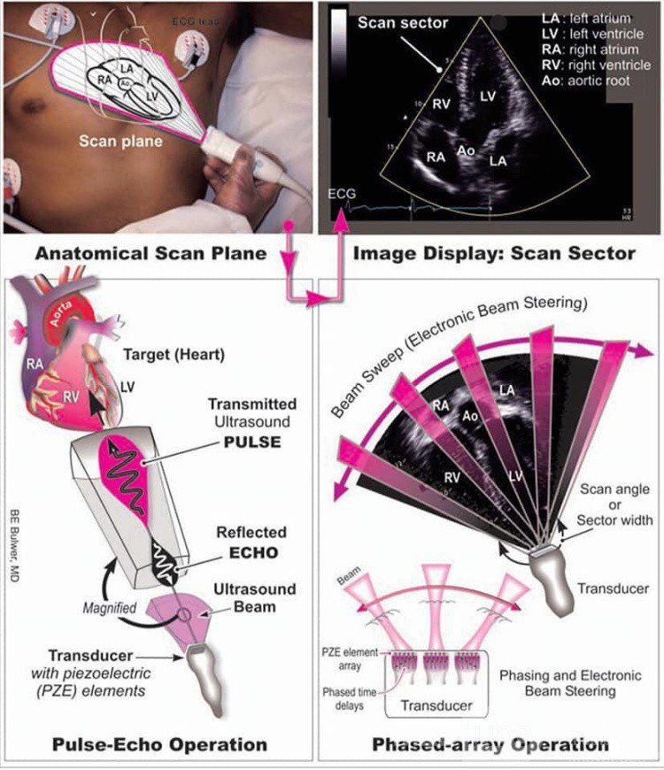 Echocardiogram: What They Show