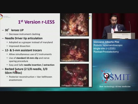Robotic Laparoendoscopic Single-Site (r-LESS) Radical Prostatectomy - SMIT 2019