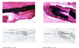 Diseases of the Ear Volume 4 The Otic Capsule