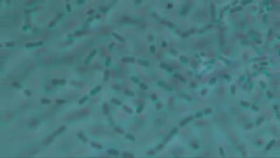 Woman - Urethra - Streptobacillus